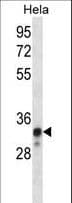 Polyclonal Rabbit anti-Human NDUFS8 Antibody (aa81-108, IHC, WB)