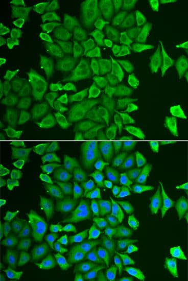 Polyclonal Rabbit anti-Human APH / APEH Antibody (IF, WB)
