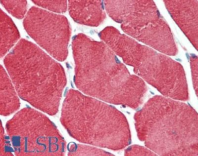 IHC-plus™ Polyclonal Rabbit anti-Human TNNC2 Antibody (aa1-160, IHC, WB)