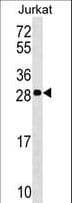 ANP32C Antibody (aa130-158)