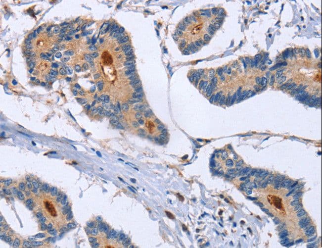 GMFG Antibody
