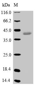 Pig GPX5 Protein (Recombinant 10His-SUMO, N-terminus + Myc, C-terminus)