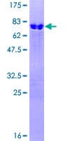 Human LMX1B Protein (Recombinant GST)