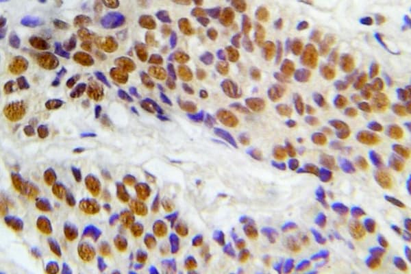 MAP3K5 / ASK1 Antibody (phospho-Ser966)