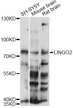 Polyclonal Rabbit anti-Human LINGO2 Antibody (WB)