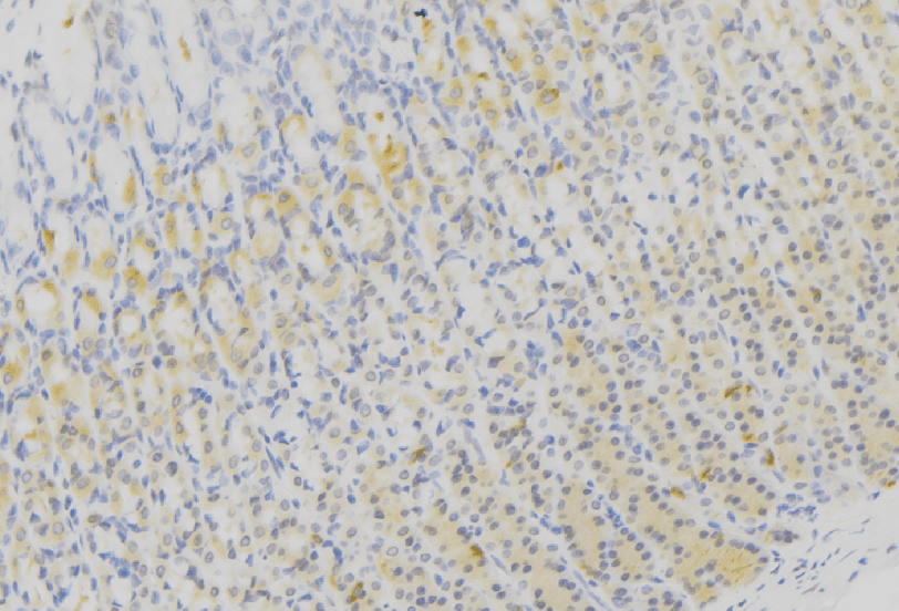 Polyclonal Rabbit anti-Human ZDHHC13 / HIP14L Antibody (IHC, WB)