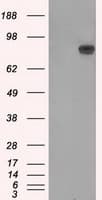 APP / Beta Amyloid Precursor Antibody (clone OTI5F1)