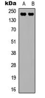 KDR / VEGFR2 / FLK1 Antibody (C-Terminus)