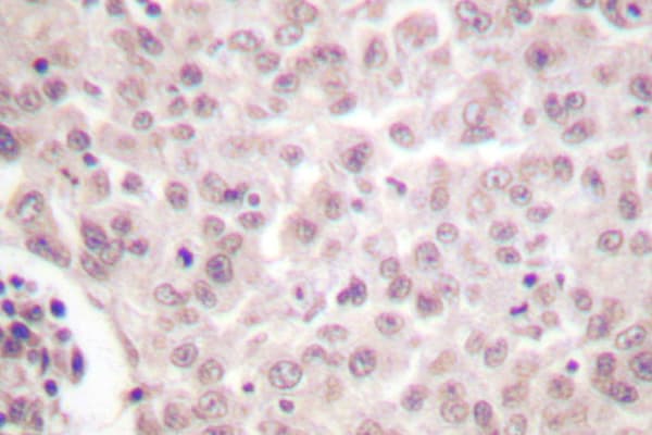 RELA / NFKB p65 Antibody (Leu523)