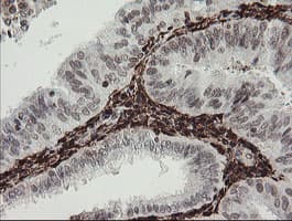 F13A1 / Factor XIIIa Antibody (clone 6F5, Carrier-free)