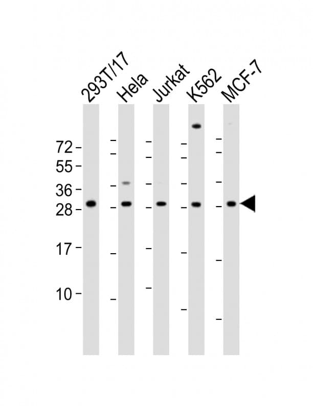 RPL13 / Ribosomal Protein L13 Antibody (Internal)