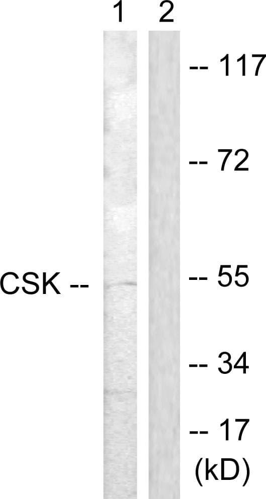 Polyclonal Rabbit anti-Human c-Src Kinase / CSK Antibody (p364, IHC, WB)