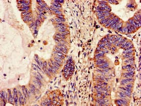 NDUFS4 Antibody
