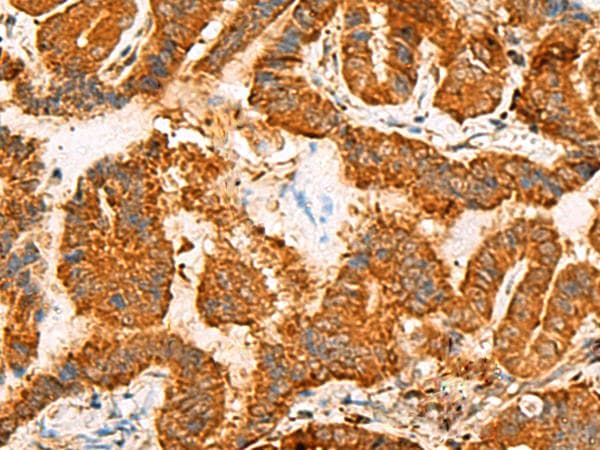 ASMTL Antibody