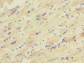 KCNJ4 / Kir2.3 Antibody