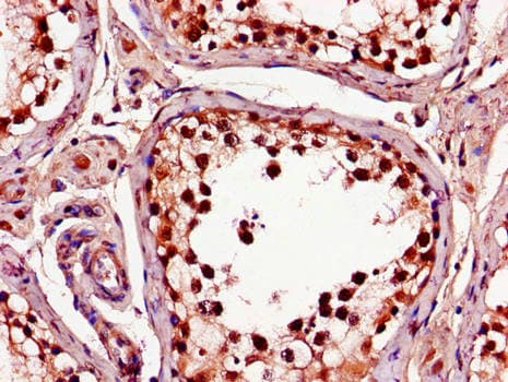 Polyclonal Rabbit anti-Human C1QTNF9B Antibody (IHC, IF)