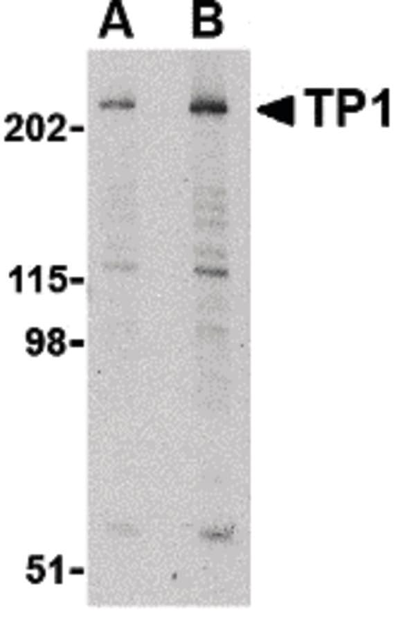 IHC-plus™ TP1 / TEP1 Antibody