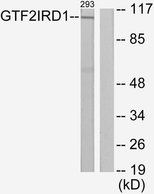 GTF3 / GTF2IRD1 Antibody (aa71-120)
