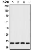 UBE2I / UBC9 Antibody (C-Terminus)