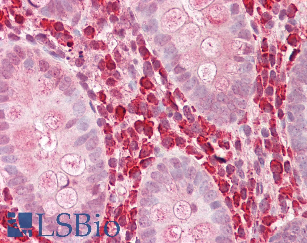 CHI3L1 / YKL-40 Antibody (aa198-247)