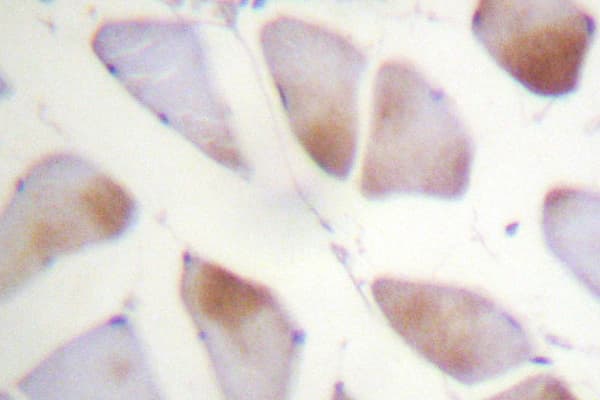 Polyclonal Rabbit anti-Human CRYAB / Alpha B Crystallin Antibody (Leu55, IHC, WB)