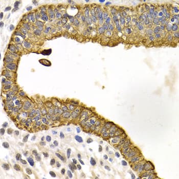 Polyclonal Rabbit anti-Human KRT5 / CK5 / Cytokeratin 5 Antibody (IHC, IF, WB)