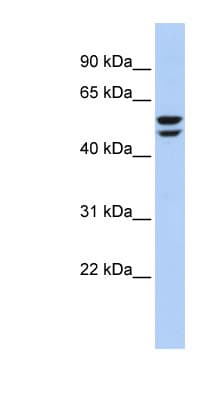 ATP6V1B2 Antibody (aa35-84)