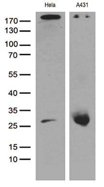 Monoclonal Mouse anti-Human CAV1 / Caveolin 1 Antibody (clone OTI2C4, aa2-104, IHC, WB)