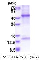 Human HPR Protein (Recombinant His)