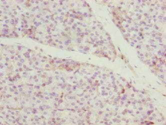 Polyclonal Rabbit anti-Human CCDC89 Antibody (IHC, WB)