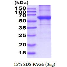 Human KRT5 / CK5 / Cytokeratin 5 Protein (Recombinant His)