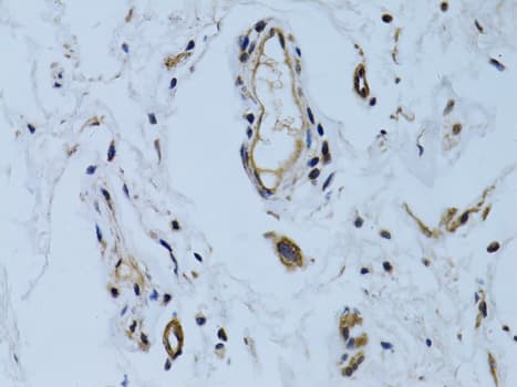 Polyclonal Rabbit anti-Human MCAM / CD146 Antibody (IHC, WB)