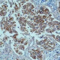 Monoclonal Mouse anti-Human CTNNB1 / Beta Catenin Antibody (IHC, WB)