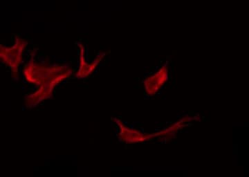 OR52E2 Antibody