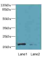 DYDC1 Antibody