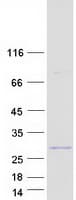 Human CFAP20 / GTL3 Protein (Recombinant Myc-DDK (Flag))