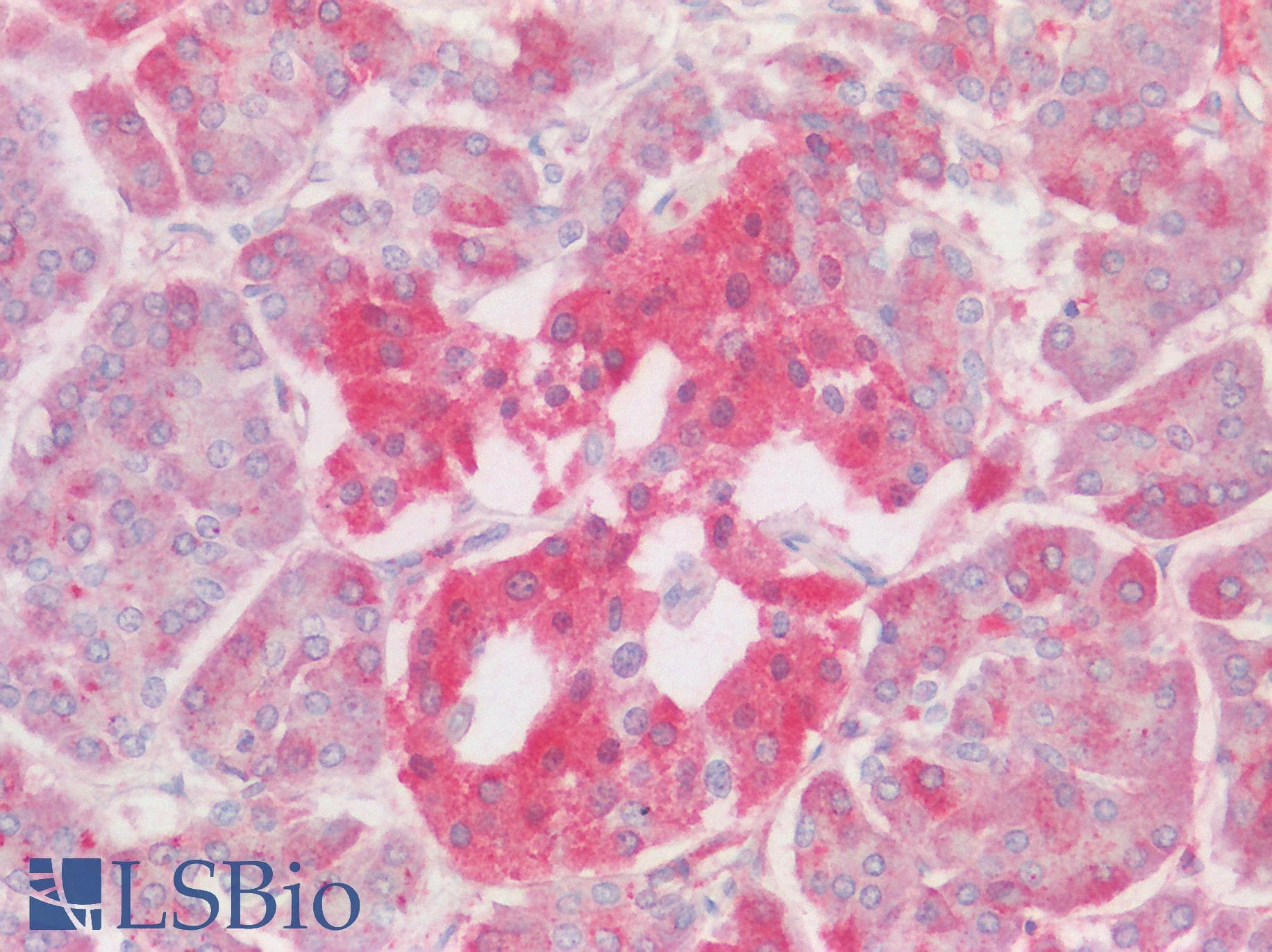 Polyclonal Rabbit anti-Human ALG11 Antibody (aa360-409, IHC, WB)