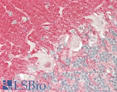 IHC-plus™ CYP39A1 Antibody (aa336-385)