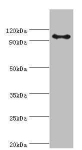AP2B1 Antibody (aa738-937)