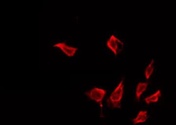 IFIT1 / ISG56 Antibody