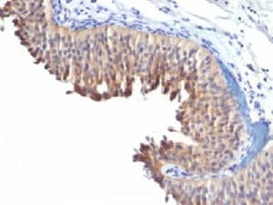 Monoclonal Mouse anti-Human KRT10 / CK10 / Cytokeratin 10 Antibody (clone LH2, Ready-to-Use, IHC, IF, WB)