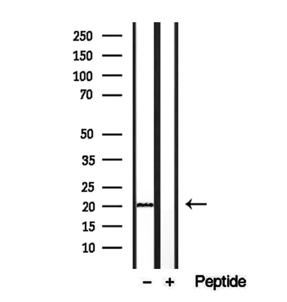 CETN2 / Centrin 2 Antibody