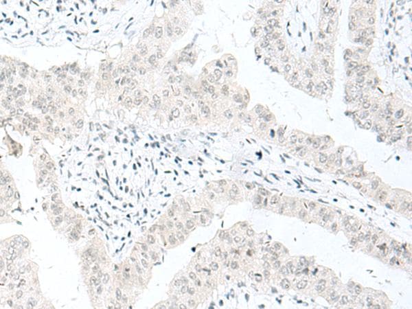 ENSA Antibody