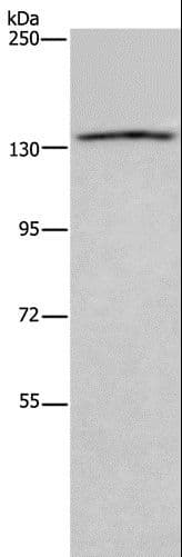 ITGAE / CD103 Antibody
