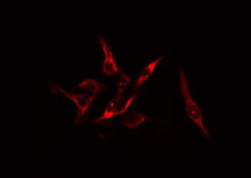 PFKFB1 Antibody