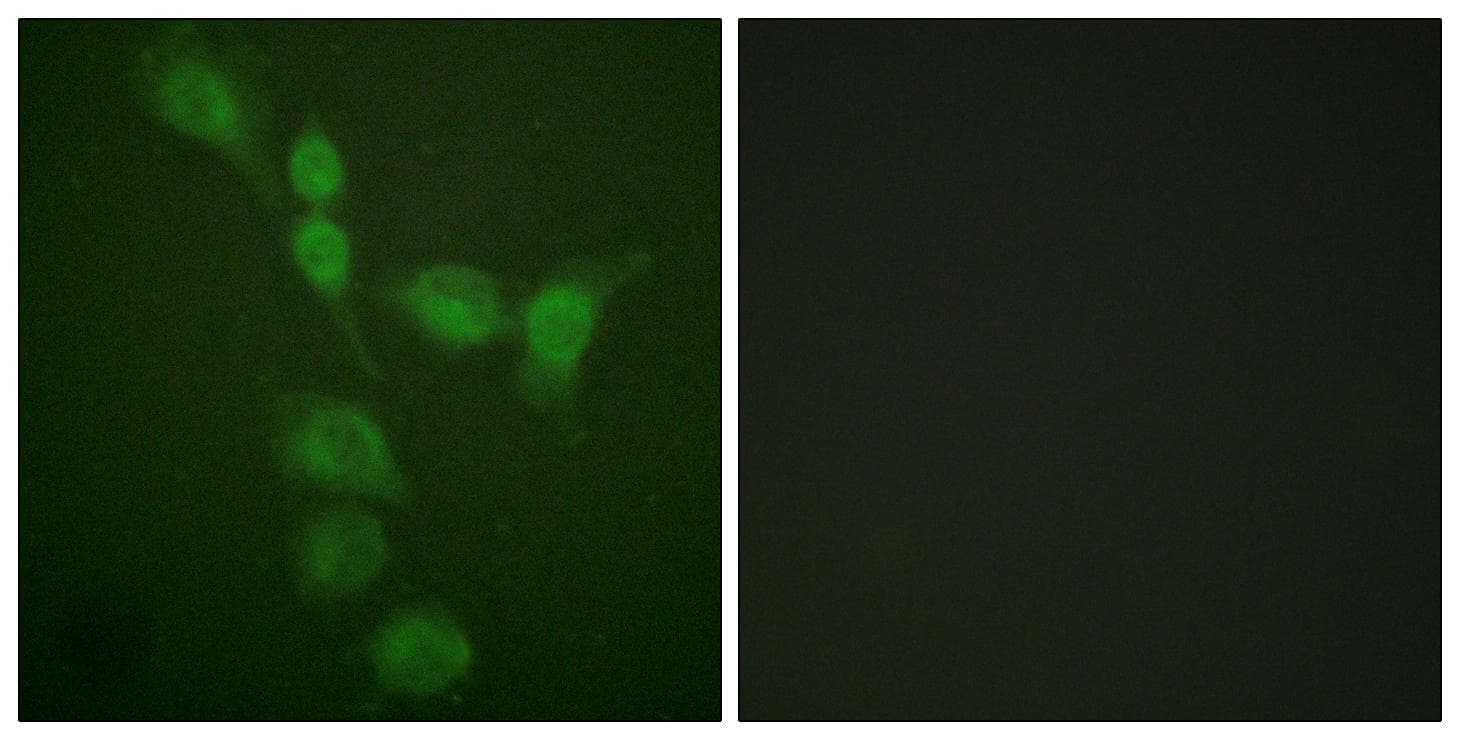 PRKAR2A/B Antibody (p197)