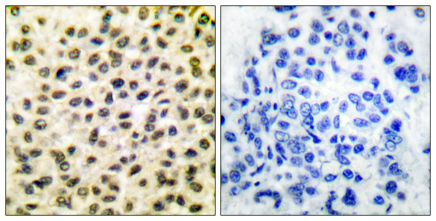 FOS / c-FOS Antibody