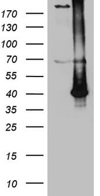 ASB13 Antibody (aa76-278, clone OTI3B2)