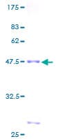 Human RAB22A / RAB22 Protein (Recombinant GST)