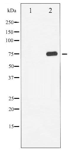 MAPT / Tau Antibody (phospho-Ser214)
